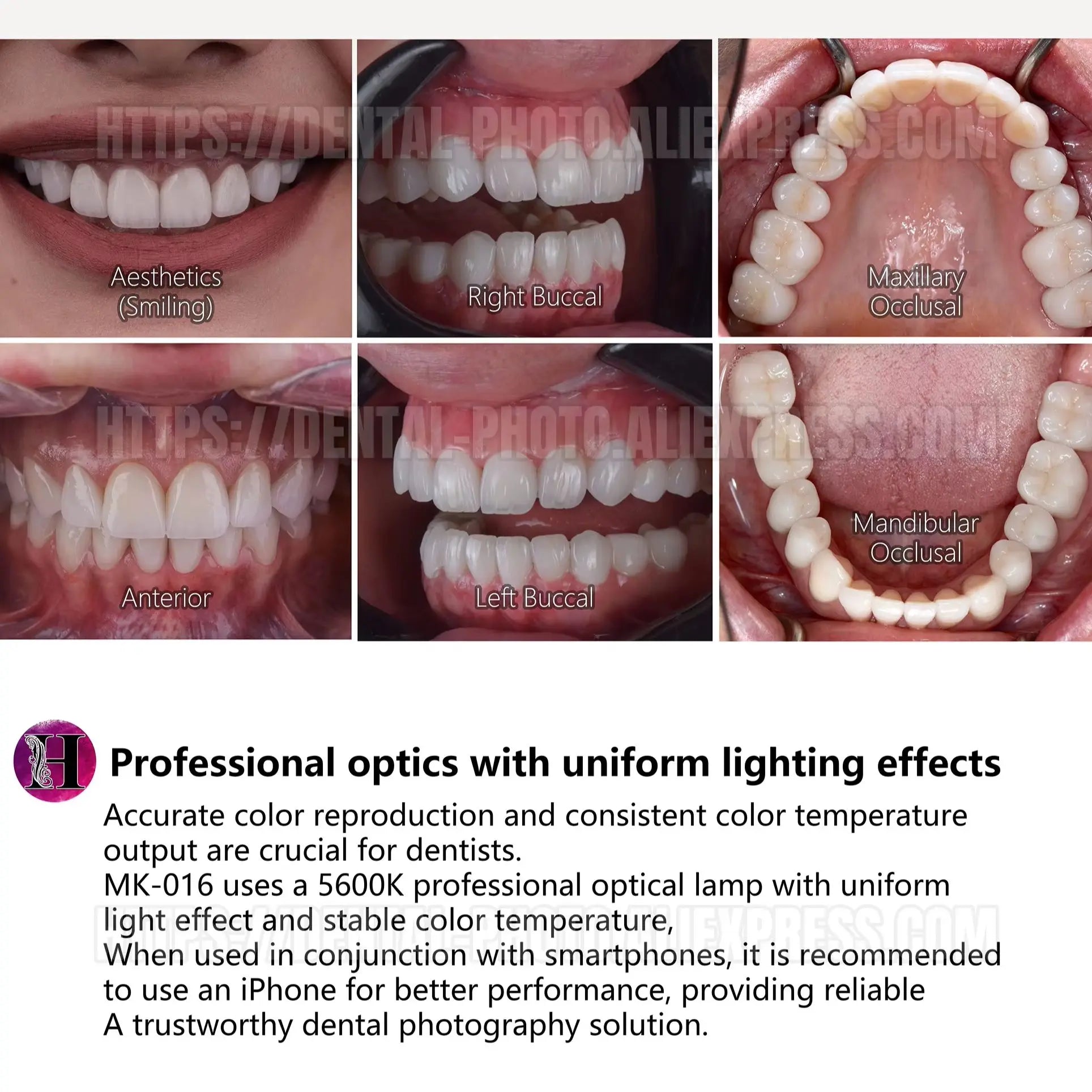 Dental Photo - MK 16 | Dental Photography Light For Cellphone. LED For Dentistry. Polarized And Macro Photos For Dentist