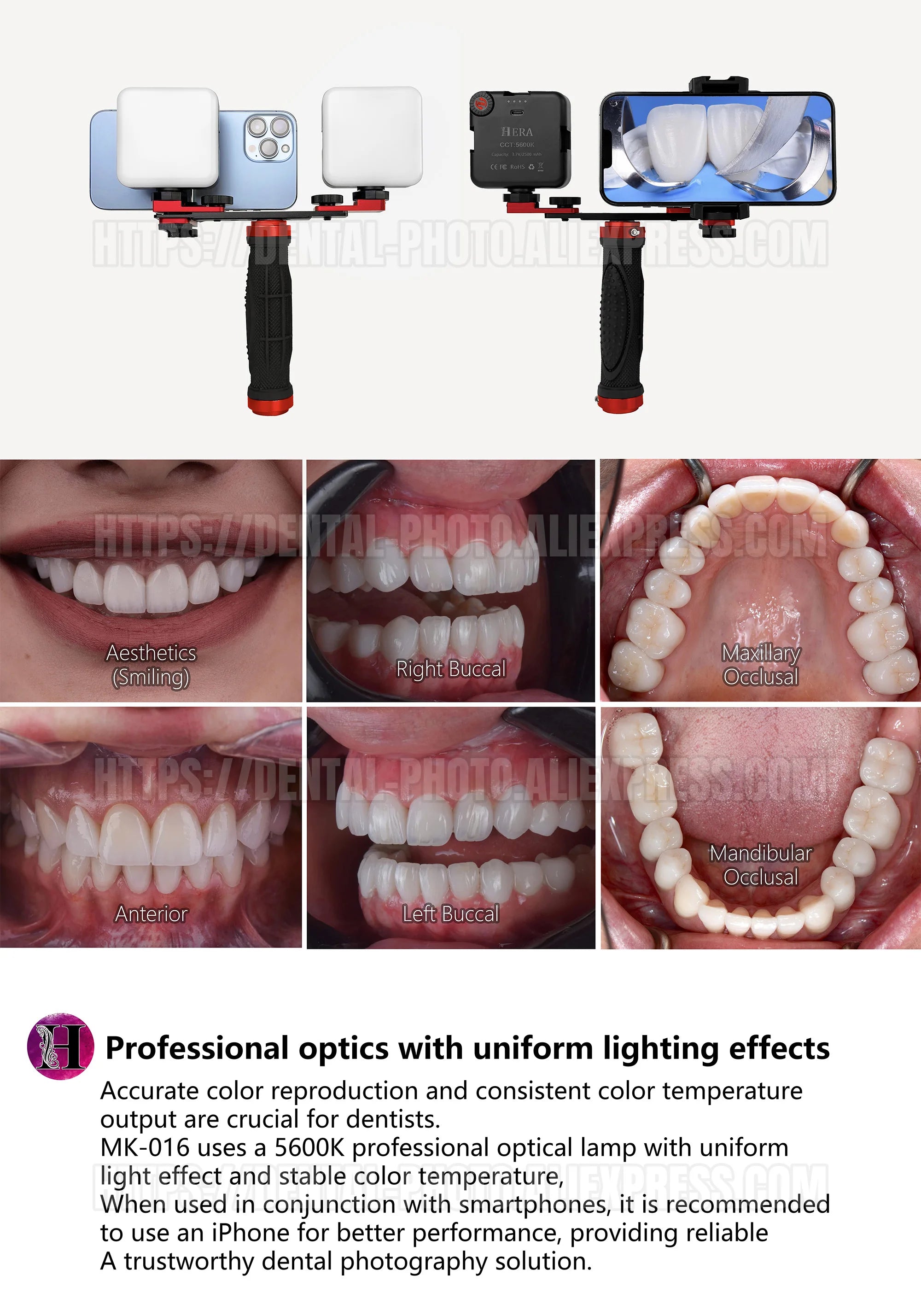 Dental Photo - MK 16 | Dental Photography Light For Cellphone. LED For Dentistry. Polarized And Macro Photos For Dentist