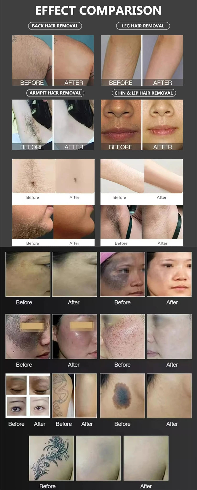 2025 New High Power Ice Titanium Diode Skin Rejuvenation 3 Wavelength 808nm 1064nm 755nm Hair Removal Beauty Salon Equipment