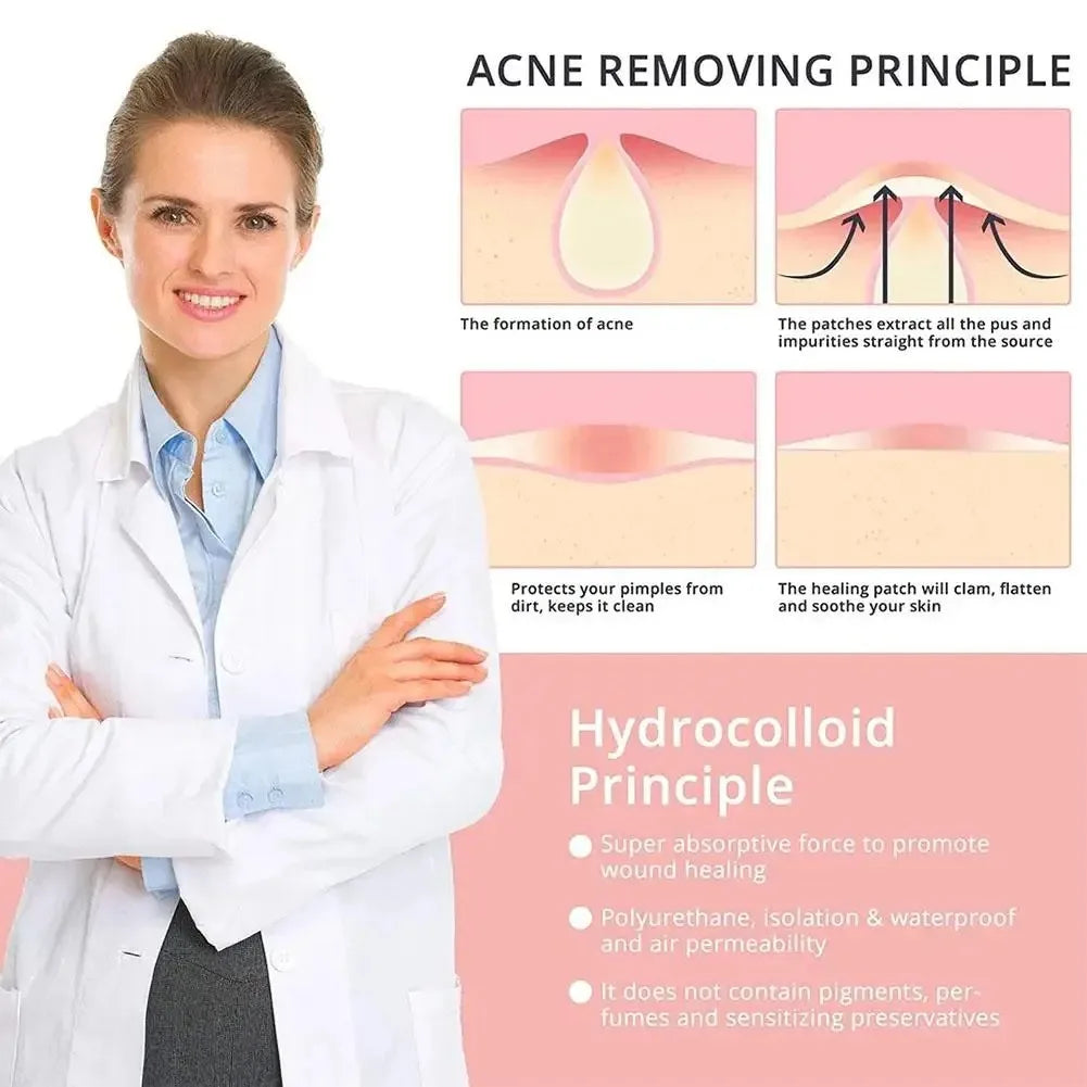 1box /72 Patch Acne Pimple Patch Stickers Acne Treatment Pimple Remover Tool Blemish Spot Facial Mask Skin Care Waterproof