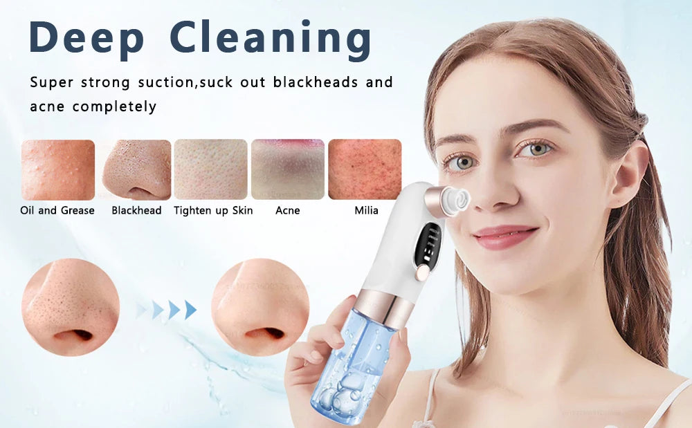 Blackhead Remover Pore Vacuum Facial Pore Cleaner Electric Comedone Whitehead Extractor Tool Rechargeable Blackhead Remover