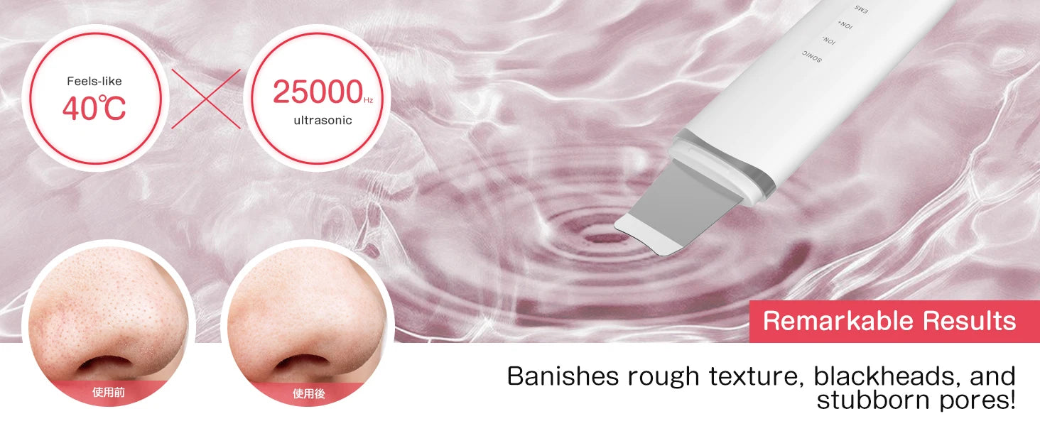 MAXGROOM Ultrasonic Skin Scrubber Peeling Blackhead Remover Deep Face Cleaning EMS Ion Ance Pore Cleaner Facial Shovel Cleaner
