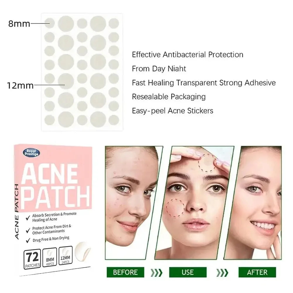 1box /72 Patch Acne Pimple Patch Stickers Acne Treatment Pimple Remover Tool Blemish Spot Facial Mask Skin Care Waterproof