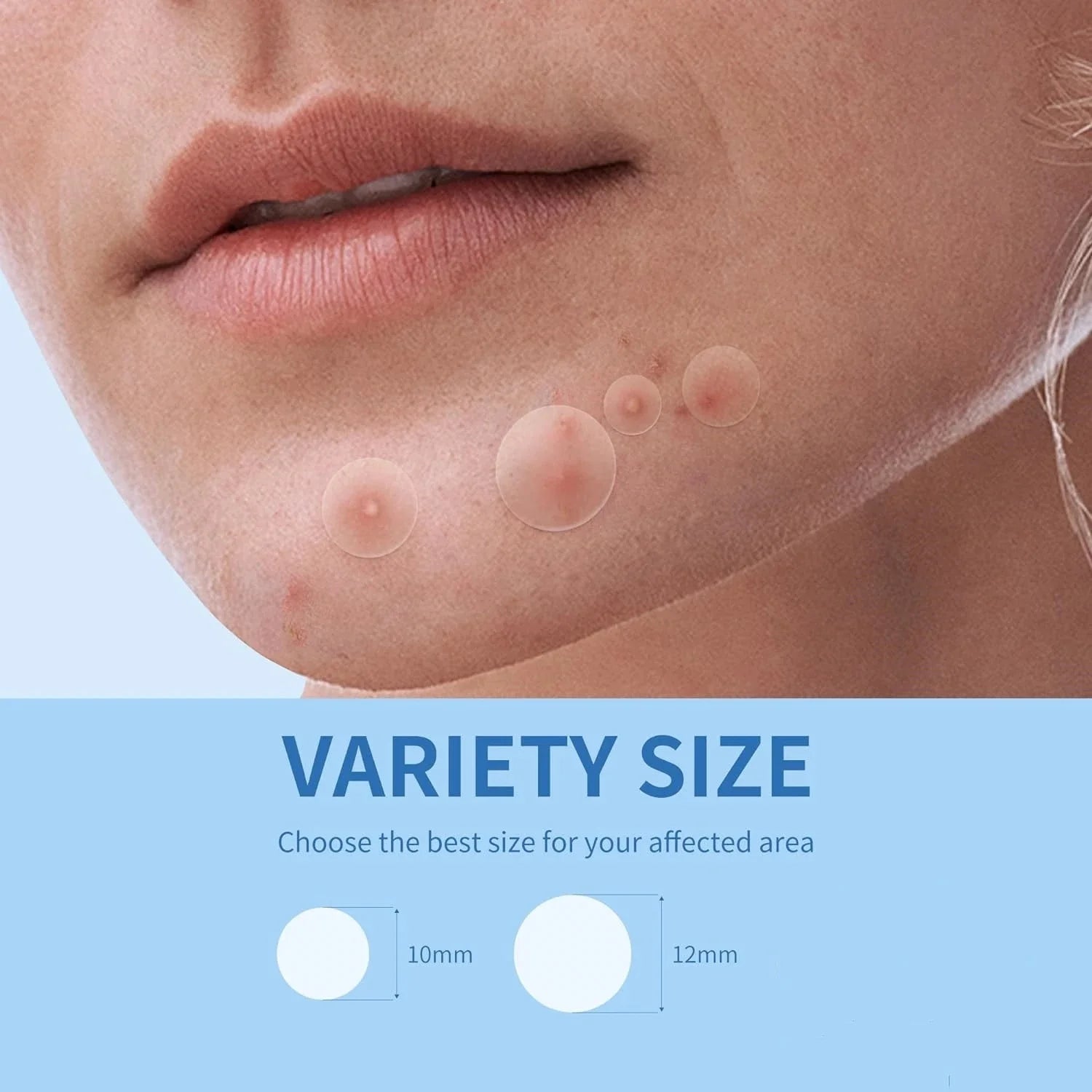 180/360PCS Invisible Acne Veneer Lump Sticker Reduce Acne Cleansing Pores Oil Removal Repair and Smooth Skin Facial Products Var