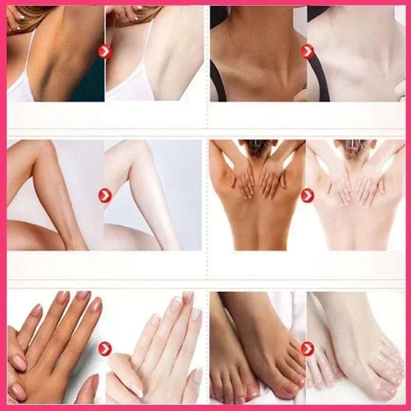 Skin Whitening Serum Private Parts Underarm Bleaching Serum Whiten Butt Knee Brighten Inner Thigh Arm Body Remove Dark Melanin
