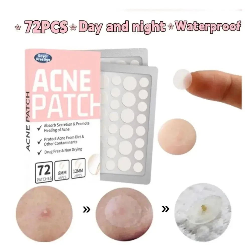 1box /72 Patch Acne Pimple Patch Stickers Acne Treatment Pimple Remover Tool Blemish Spot Facial Mask Skin Care Waterproof