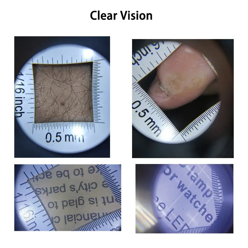 Magnifier 45X dermatoscope handle smooth clear vision with measure Scale 45X type B bigger vision with UV light