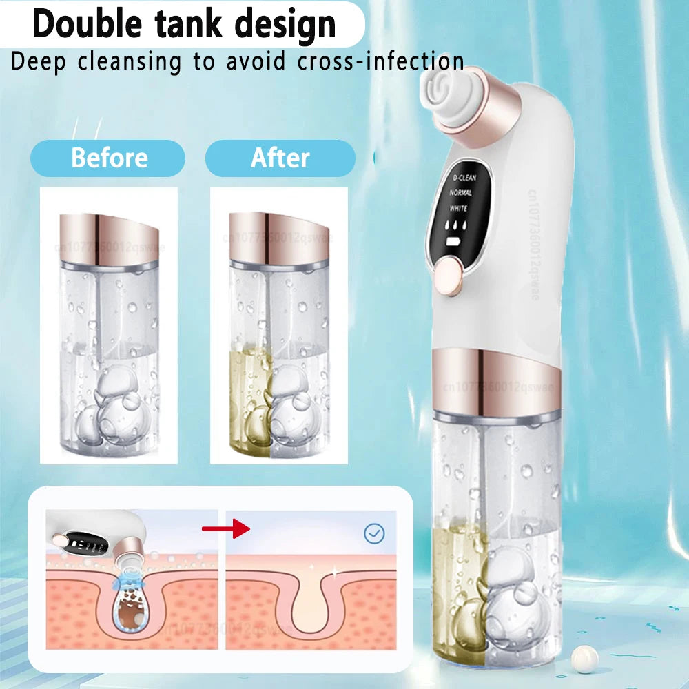 Blackhead Remover Pore Vacuum Facial Pore Cleaner Electric Comedone Whitehead Extractor Tool Rechargeable Blackhead Remover