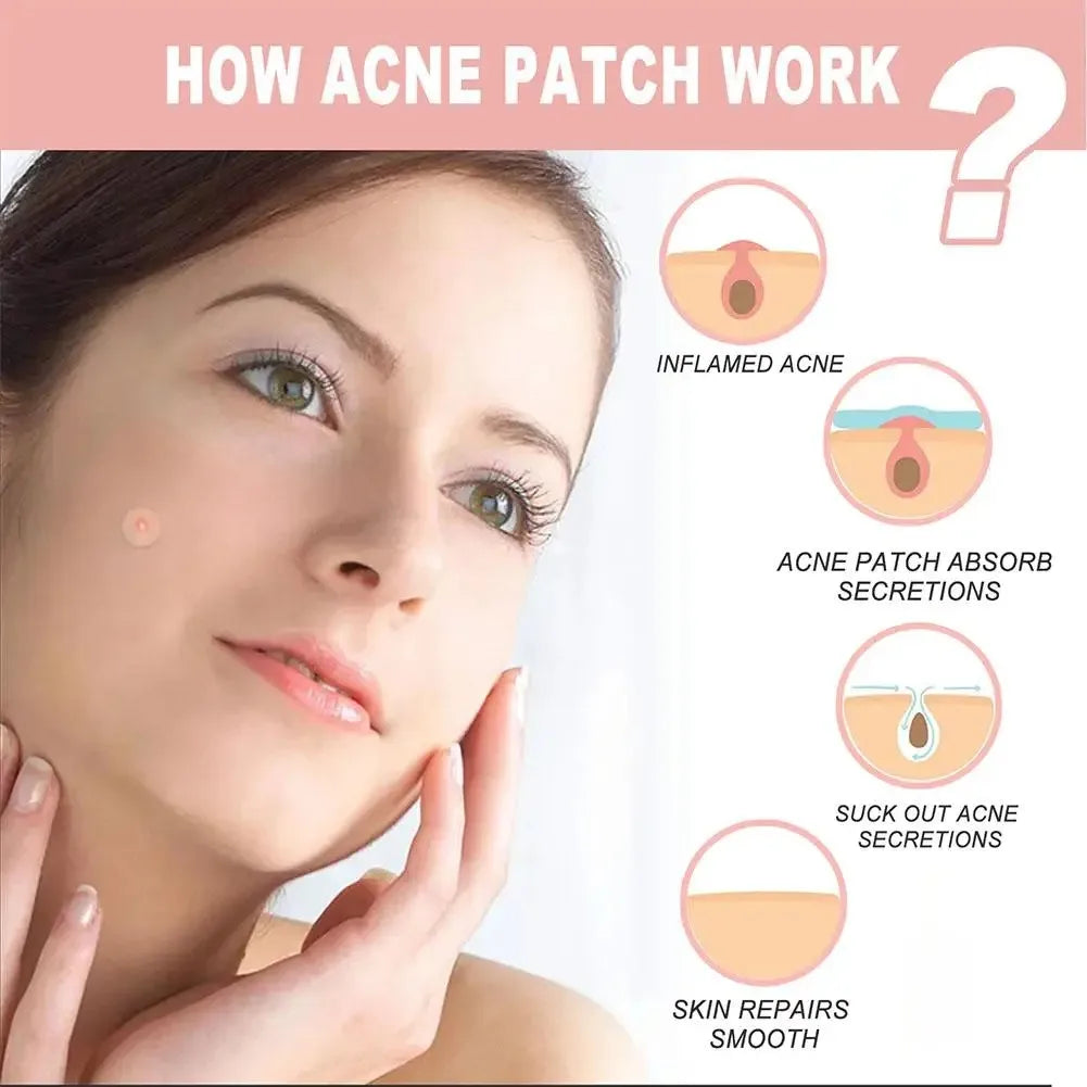 1box /72 Patch Acne Pimple Patch Stickers Acne Treatment Pimple Remover Tool Blemish Spot Facial Mask Skin Care Waterproof