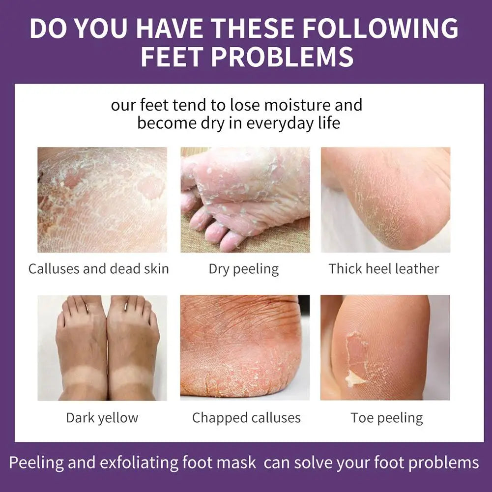 Exfoliating Foot Mask Lavender oil Moisturizing Remove Dead Skin Calluses Heel Crack Repair Foot Mask winter Foot Skin Care