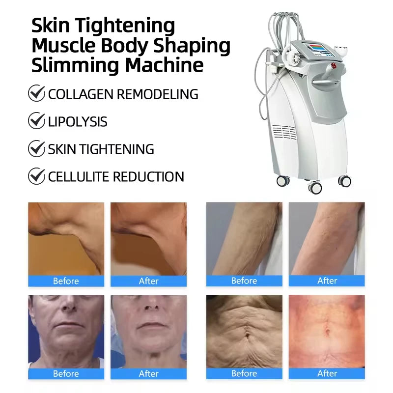 Venus Legacy 2025 Portable Radio Frequency Original Cavitation Body Machine by Vacuum Slimming Cellulite Reduction Technology