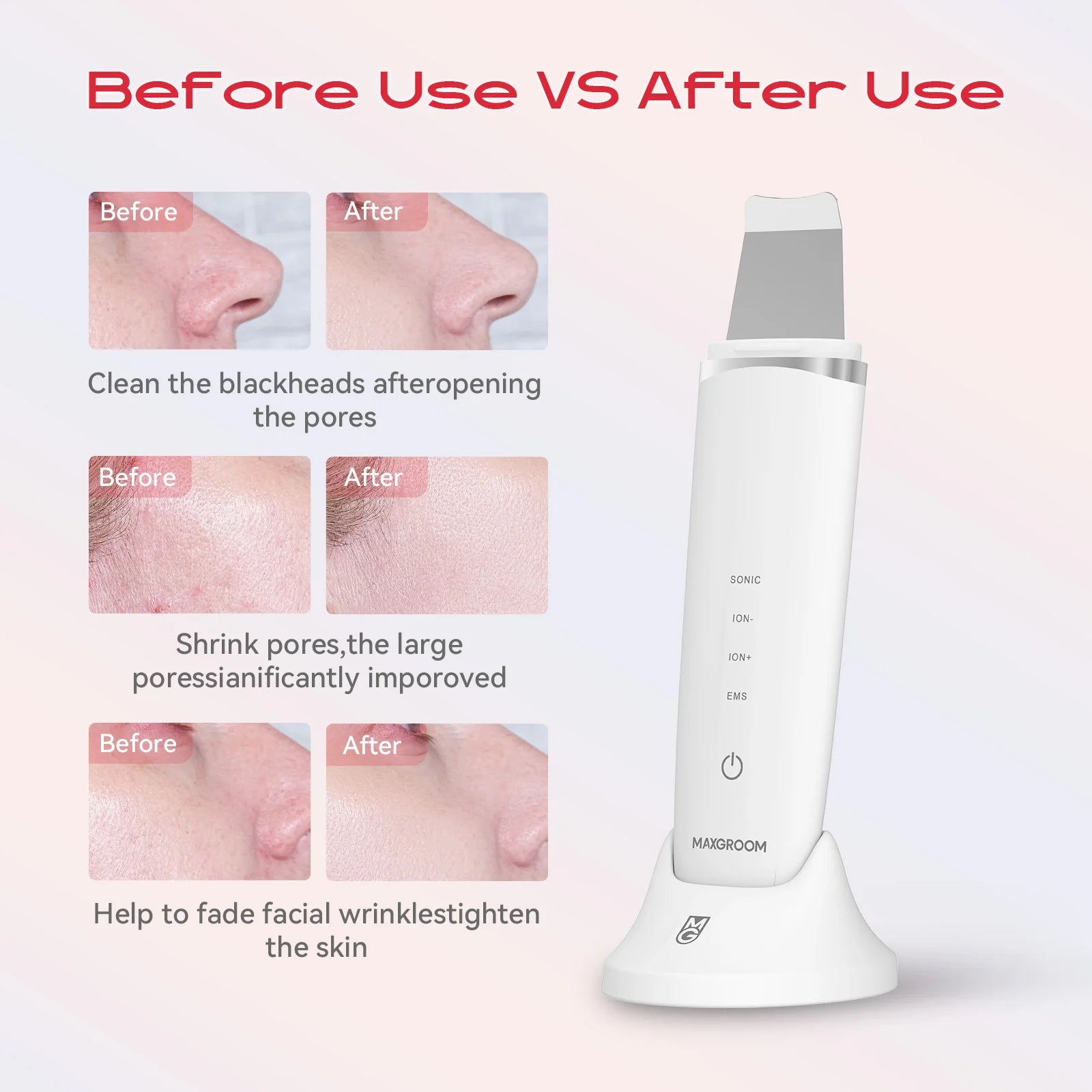 MAXGROOM Ultrasonic Skin Scrubber Peeling Blackhead Remover Deep Face Cleaning EMS Ion Ance Pore Cleaner Facial Shovel Cleaner