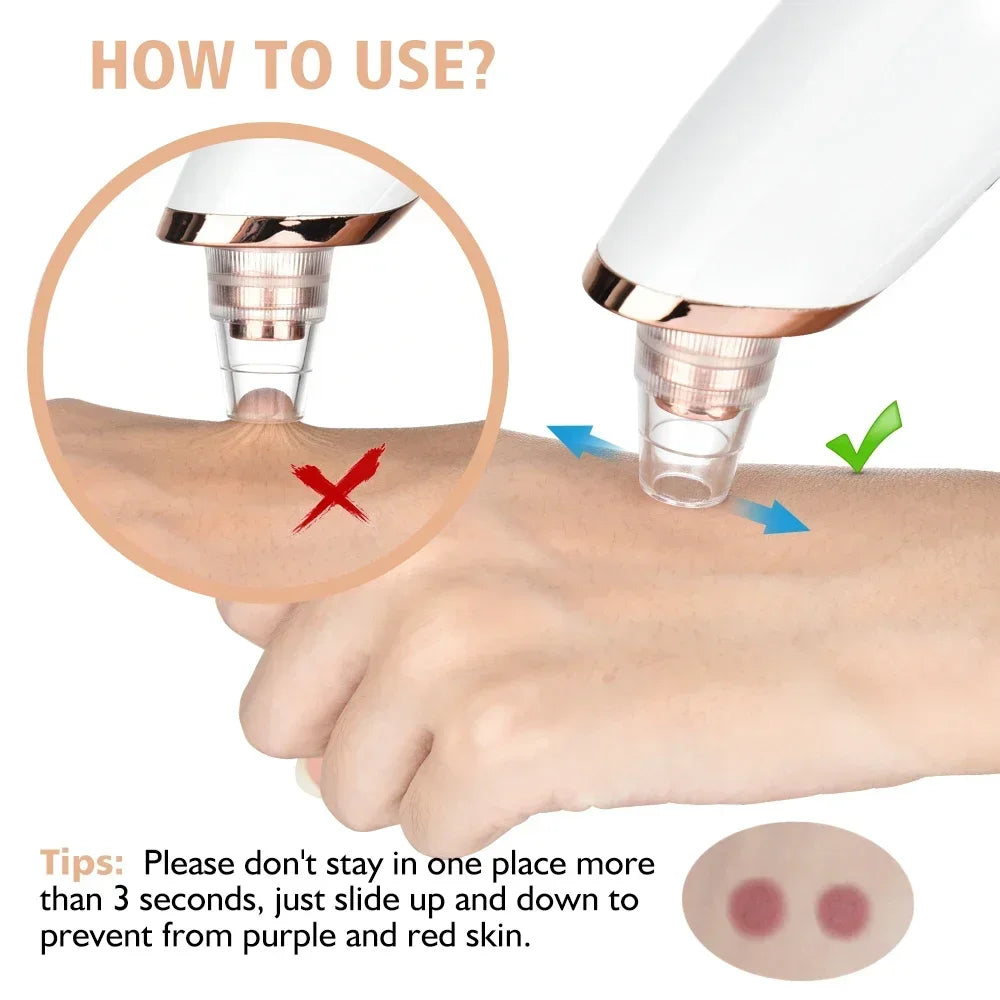 Blackhead Remover Vacuum Suction USB Rechargeable Facial Pore Cleaner Spot Acne Pimple Black Head Extractor Skin Care Tool Kit