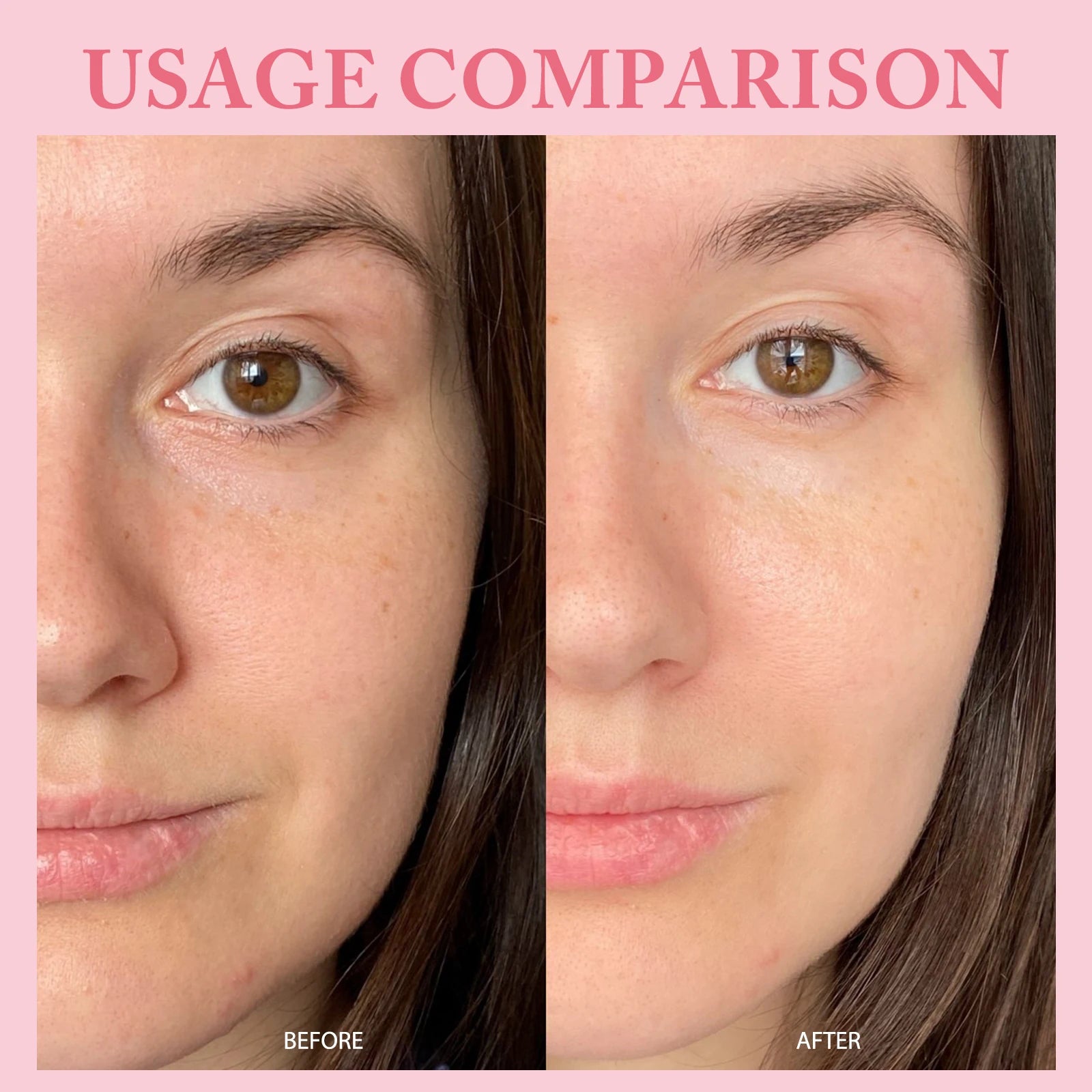 10Vials/Box PDRN PINK ONE DAY SERUM Firming Hydrating Ampoule Smoothing Skin Oil Control Pore Refining Skin Rejuvenation Essence