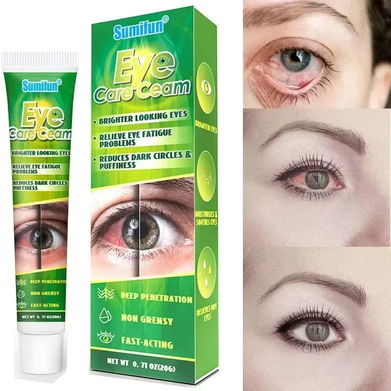 Sumifun 20g Chinese Herbal Medicine Eye Care Cream Brighter Looking Eyes Relieve Eye Fatigue Problems Eyes Red Blood Clear