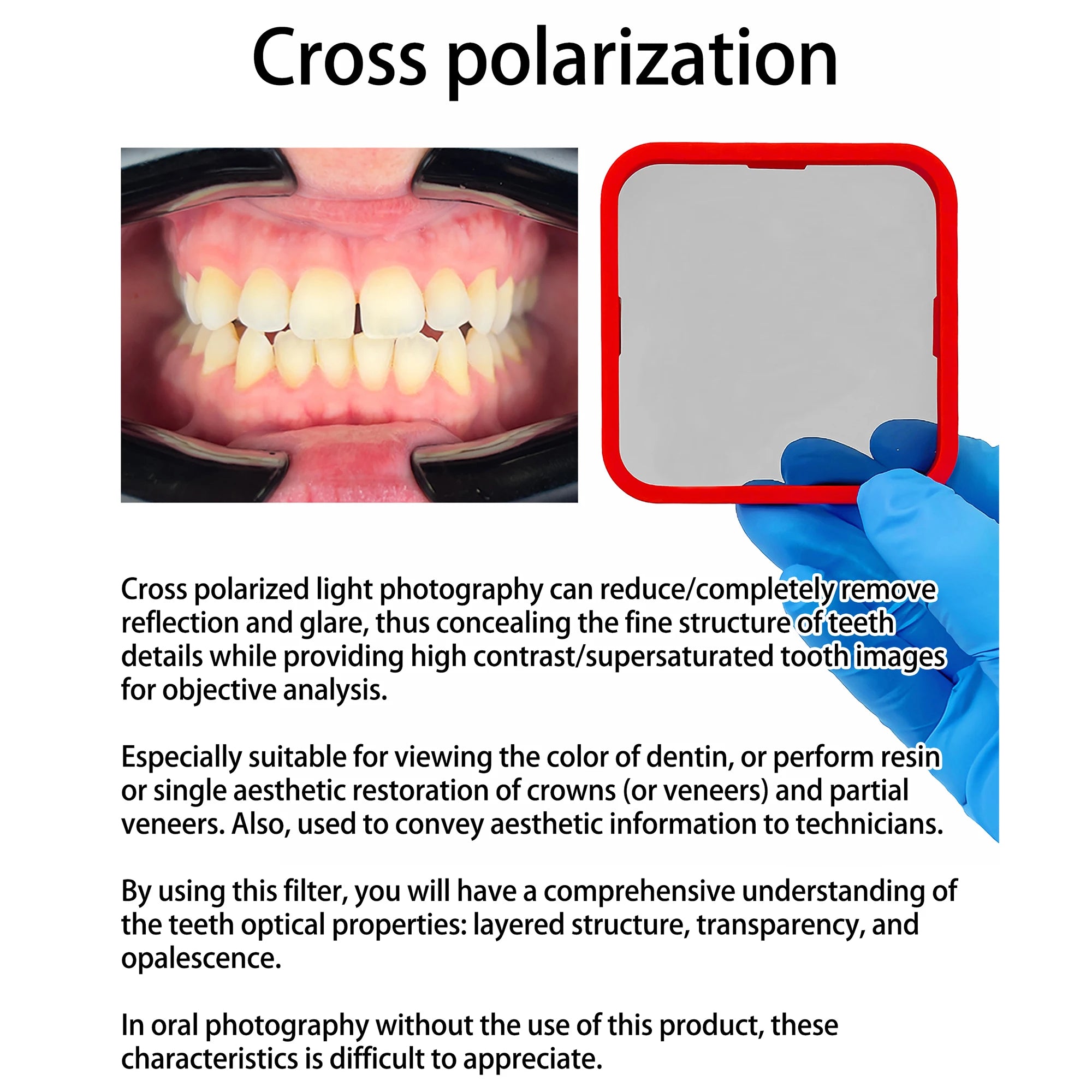 Dental Photo - MK 16 | Dental Photography Light For Cellphone. LED For Dentistry. Polarized And Macro Photos For Dentist