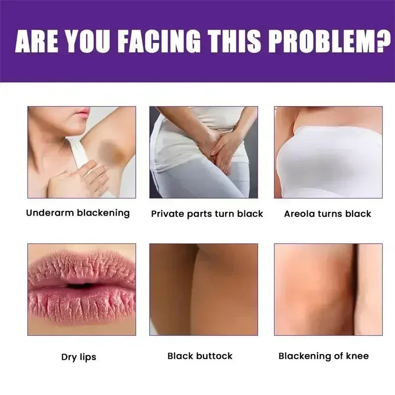 Skin Whitening Serum Private Parts Underarm Bleaching Serum Whiten Butt Knee Brighten Inner Thigh Arm Body Remove Dark Melanin