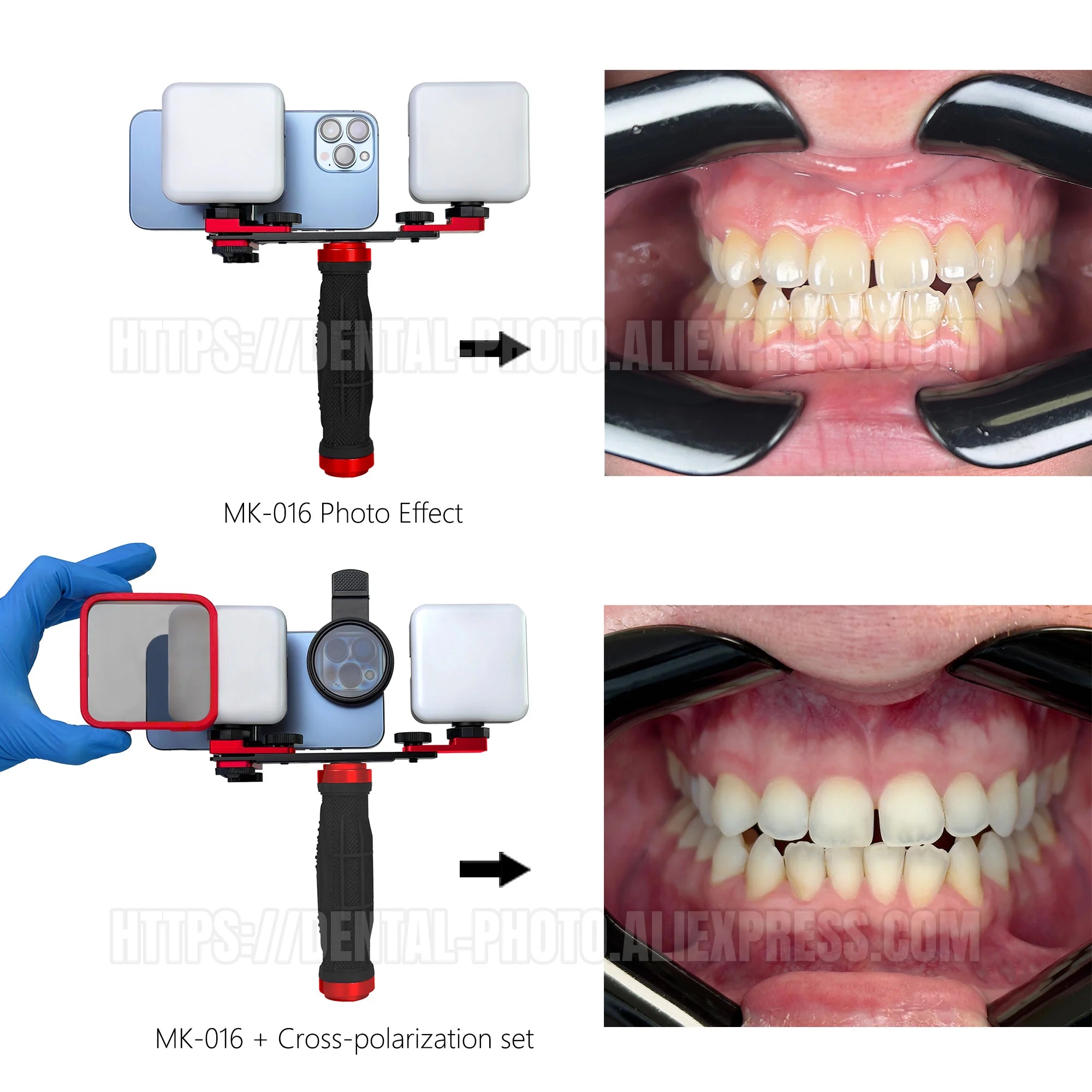 Dental Photo - MK 16 | Dental Photography Light For Cellphone. LED For Dentistry. Polarized And Macro Photos For Dentist