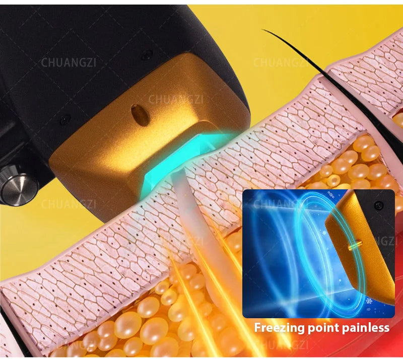 2025 Best Depilator New Ice Platinum Cooling System Skin Care 808nm Diode Laser Hair Removal Machine 3-Wavelength