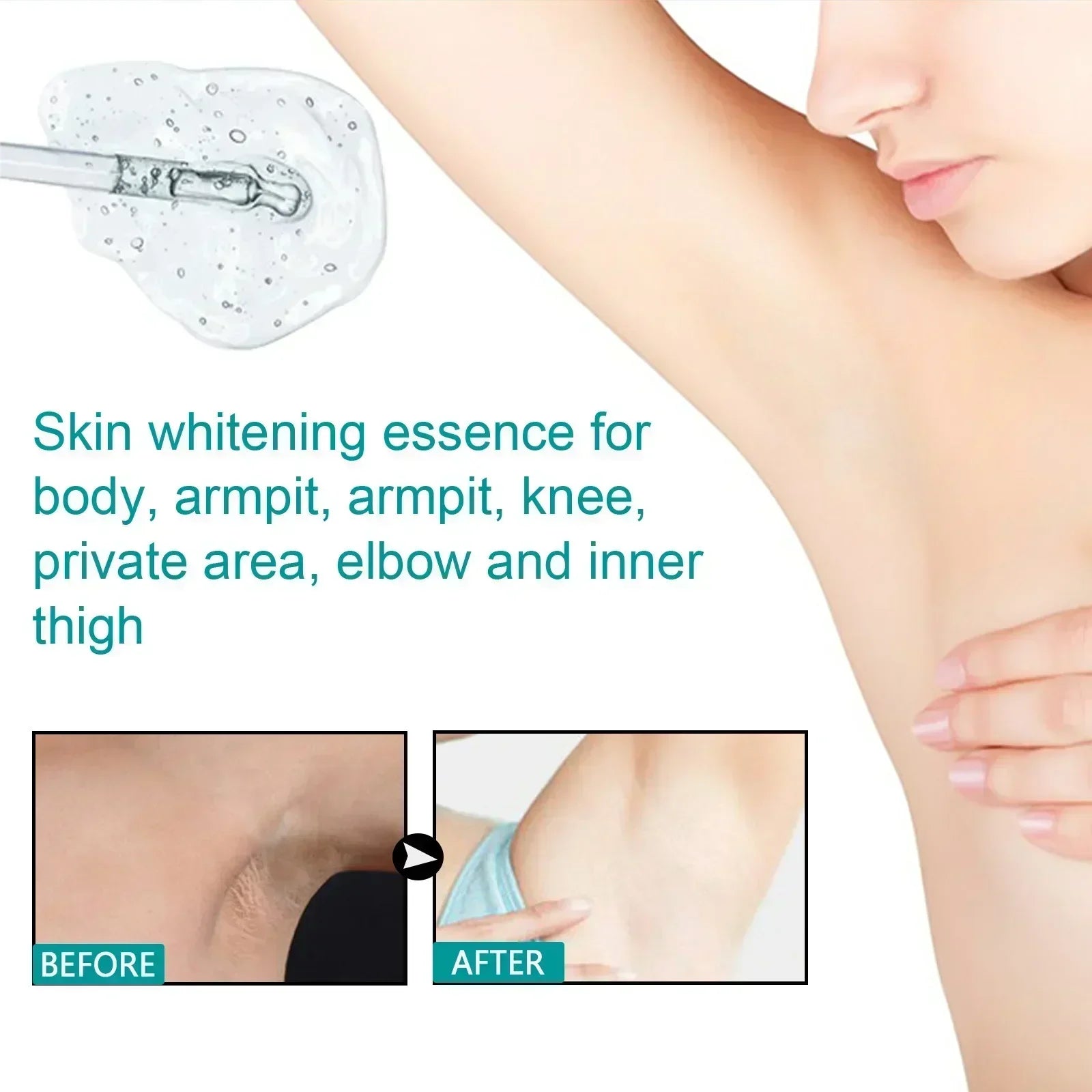 Skin Whitening Serum Private Parts Underarm Bleaching Serum Whiten Butt Knee Brighten Inner Thigh Arm Body Remove Dark Melanin