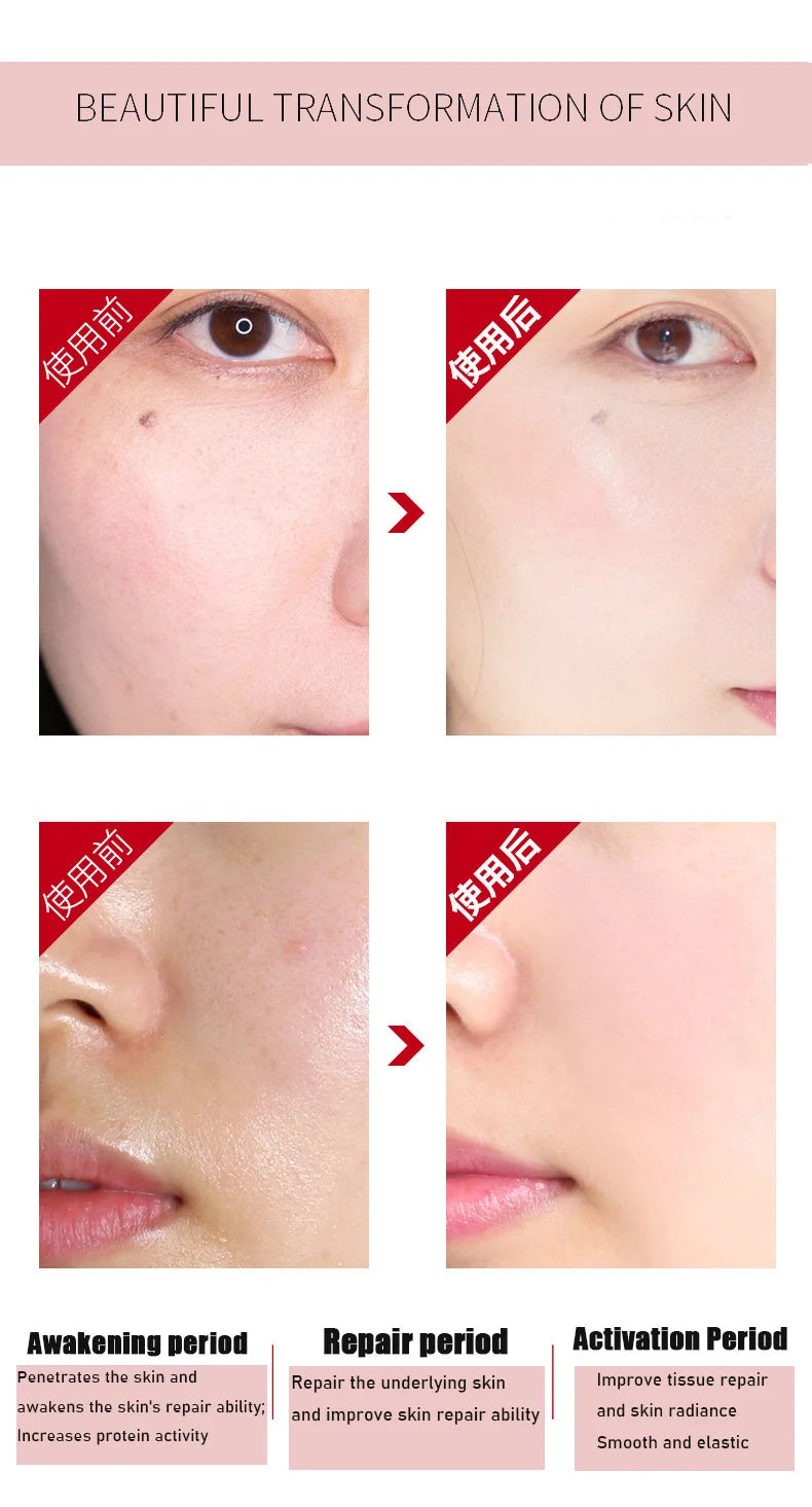 Anti- Wrinkle Face Skin care Serum Set Fade Fine Lines Facial Moisturizing brightning Anti Aging Firming Skin Care Essence oil