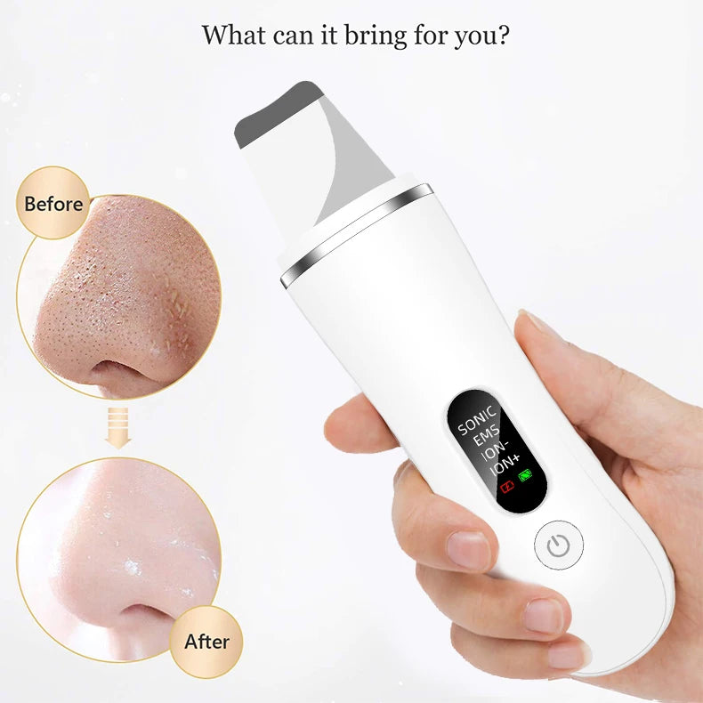 New Ultrasonic Skin Scrubber Facial Deep Cleansing Blackhead Remove Ultrasonic Cleansing Cavitation Peeling Shovel Skin Scrubber