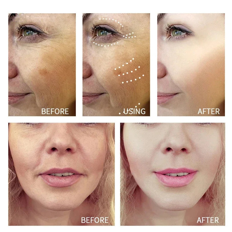 Retinol Wrinkle Remover Cream Shot Tightening Firming Fine Line Enhancer Moisturizing Pore Shrinking Repair Serum Skin Care Set