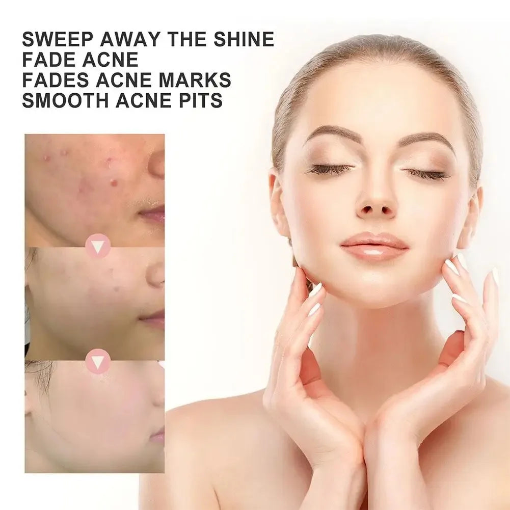 1box /72 Patch Acne Pimple Patch Stickers Acne Treatment Pimple Remover Tool Blemish Spot Facial Mask Skin Care Waterproof