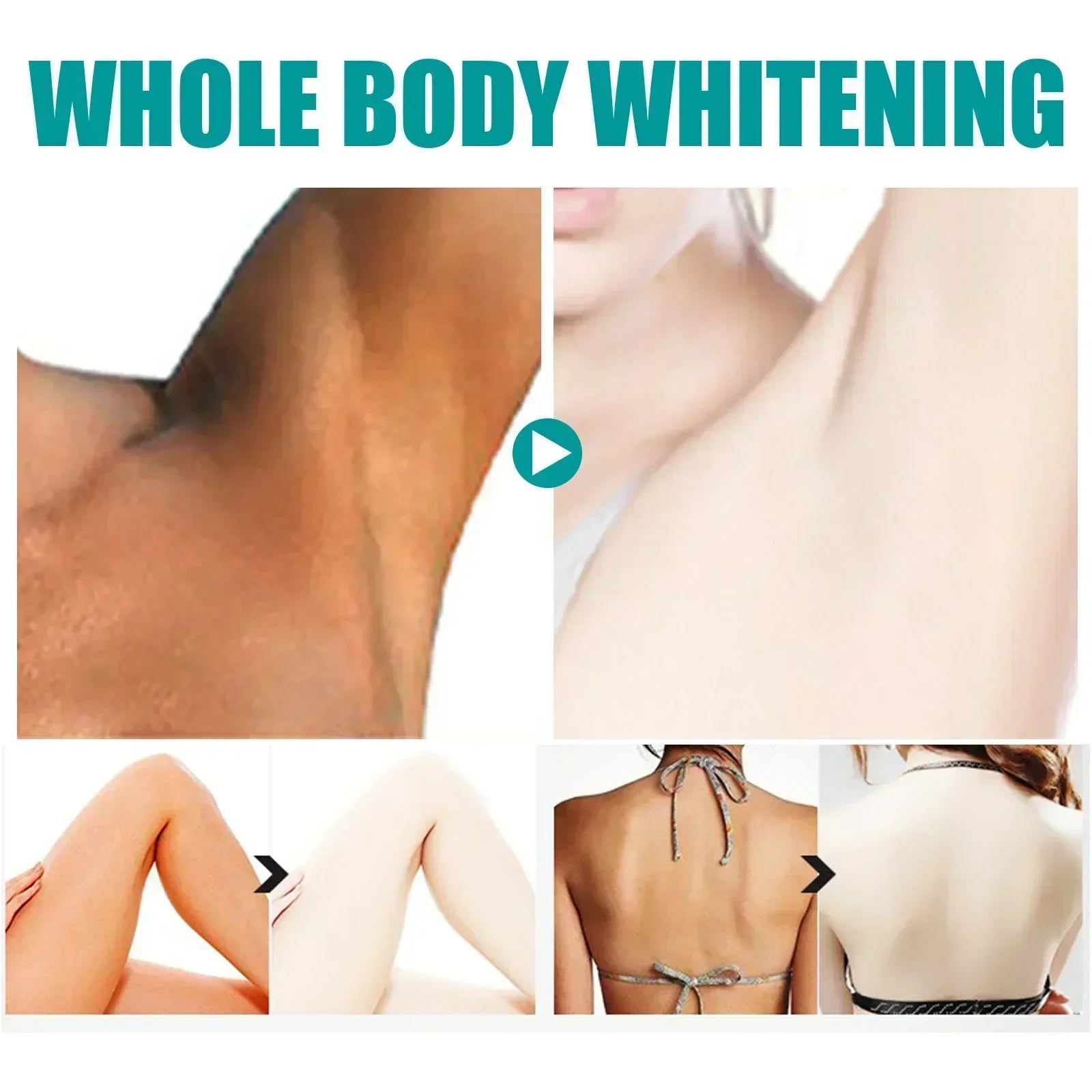 Skin Whitening Serum Private Parts Underarm Bleaching Serum Whiten Butt Knee Brighten Inner Thigh Arm Body Remove Dark Melanin