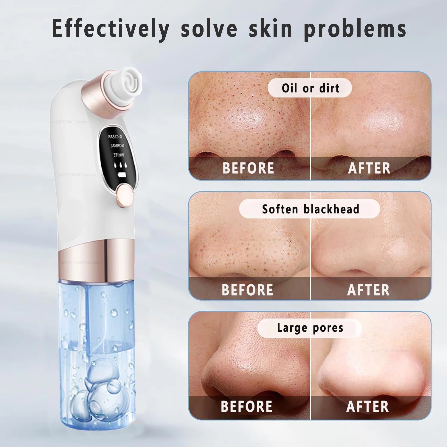 Blackhead Remover Pore Vacuum Facial Pore Cleaner Electric Comedone Whitehead Extractor Tool Rechargeable Blackhead Remover