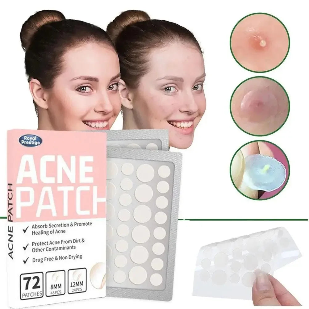 1box /72 Patch Acne Pimple Patch Stickers Acne Treatment Pimple Remover Tool Blemish Spot Facial Mask Skin Care Waterproof