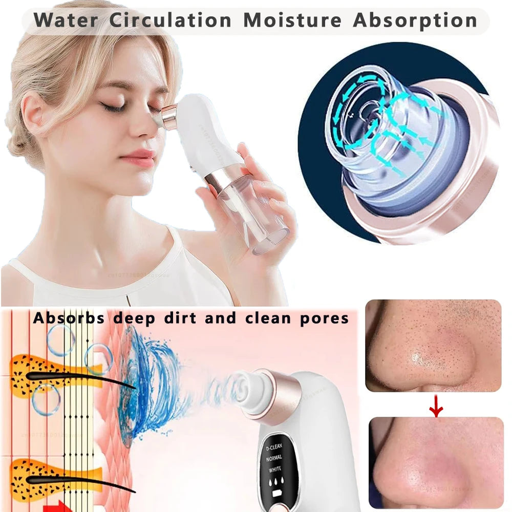 Blackhead Remover Pore Vacuum Facial Pore Cleaner Electric Comedone Whitehead Extractor Tool Rechargeable Blackhead Remover