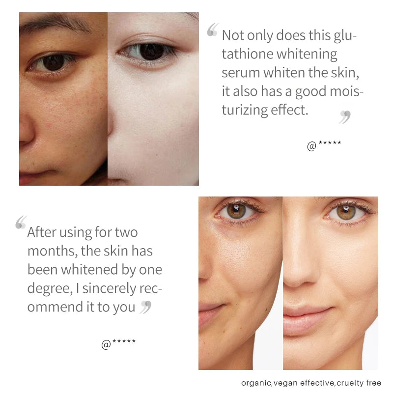 Lanthome Glutathione Whitening Serum Fade Black Dark Spots Vitamin C Defects Reduce Facial Oil Brightening Firming For Women