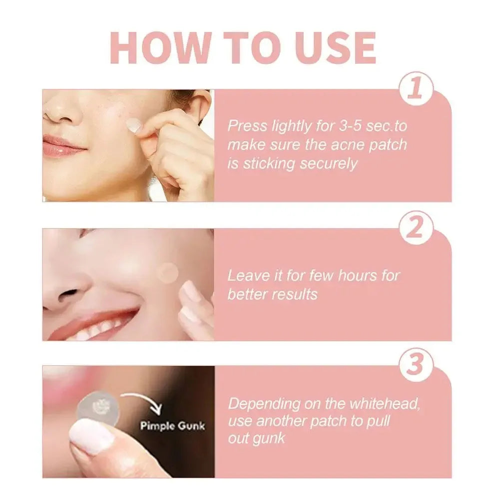 1box /72 Patch Acne Pimple Patch Stickers Acne Treatment Pimple Remover Tool Blemish Spot Facial Mask Skin Care Waterproof