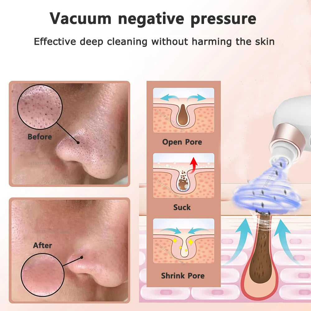 Blackhead Remover Pore Vacuum Facial Pore Cleaner Electric Comedone Whitehead Extractor Tool Rechargeable Blackhead Remover