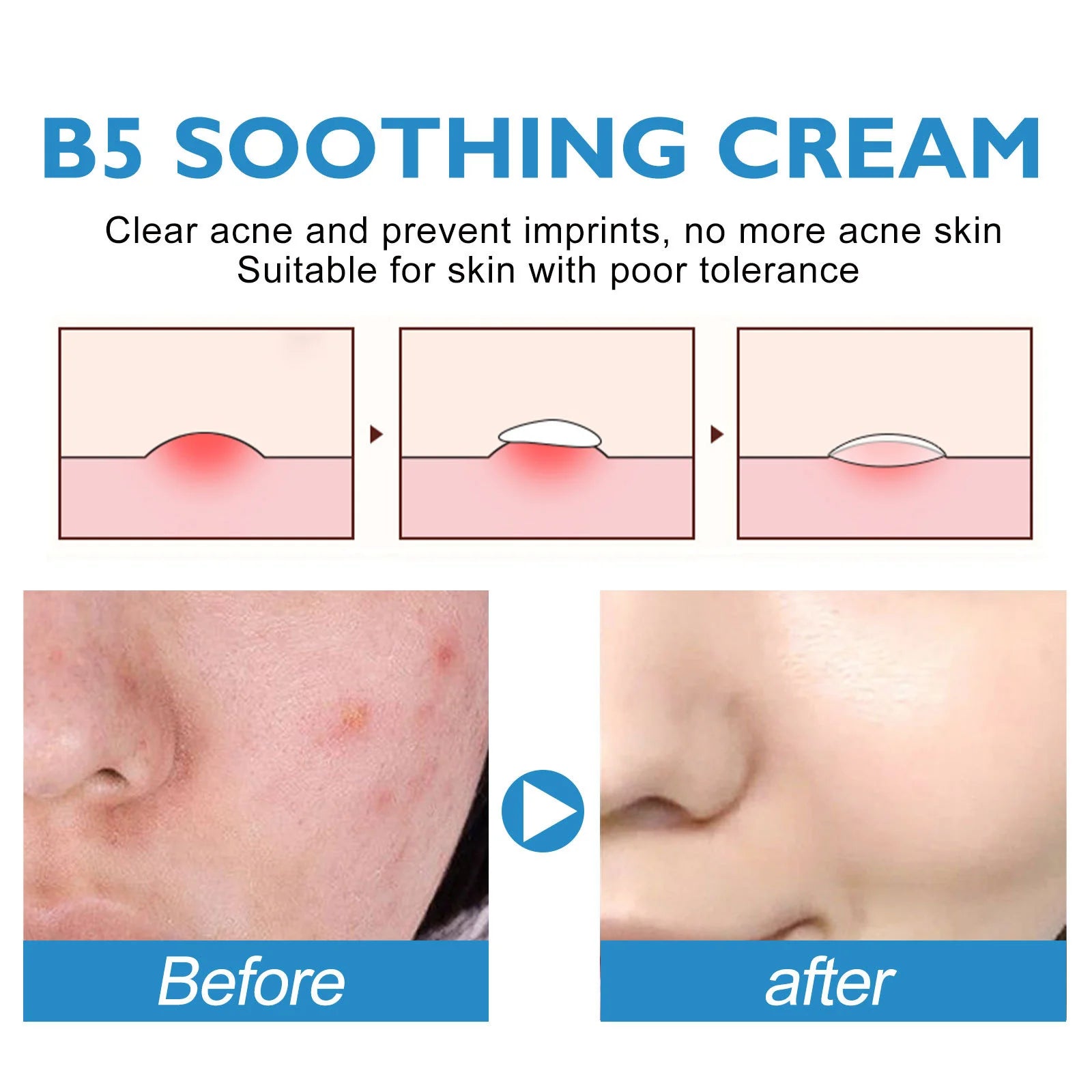 Cicaplast Repair Cream B5 40ml Moisturizer Repair Cream Soothes Redness Itching Nourishes Improve Repair Sunscreen Cream
