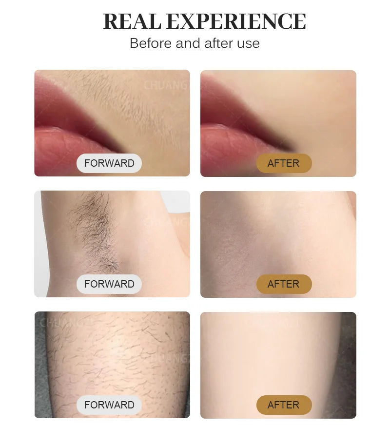 2025 Best Depilator New Ice Platinum Cooling System Skin Care 808nm Diode Laser Hair Removal Machine 3-Wavelength