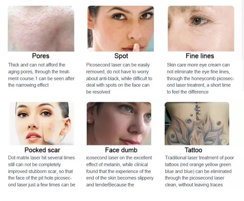 2025 Device Soprano Titanium 808 Diode Laser Hair Removal Machine 3 wavelength Painless Laser Hair 3000W Device
