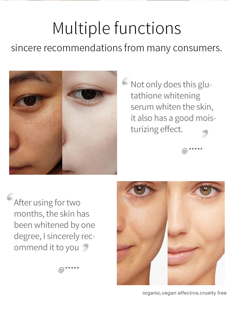 Lanthome Glutathione Whitening Serum Fade Black Dark Spots Vitamin C Defects Reduce Facial Oil Brightening Firming For Women