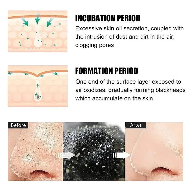 20/40/60/100/120/140Pcs Deep Cleansing Nose Pores And Blackheads - Nose Cleaning Patch, Cleansing Facial Care Tool