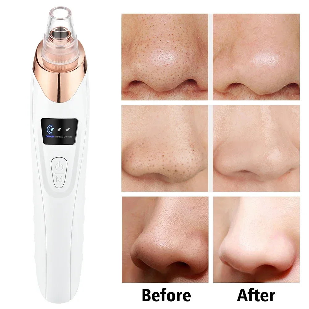Blackhead Remover Vacuum Suction USB Rechargeable Facial Pore Cleaner Spot Acne Pimple Black Head Extractor Skin Care Tool Kit