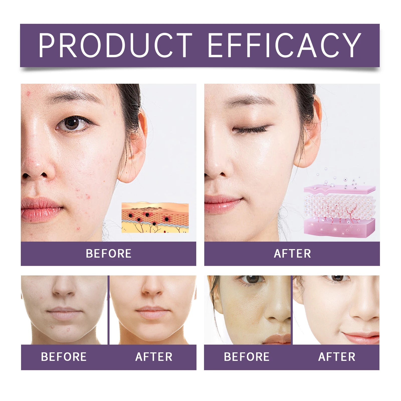 Nicotinamide Face Serum Anti-Acne Shrink Pores Brightening Lighten Moisturizing Essence Improve Rough Skin Care Firming Serum