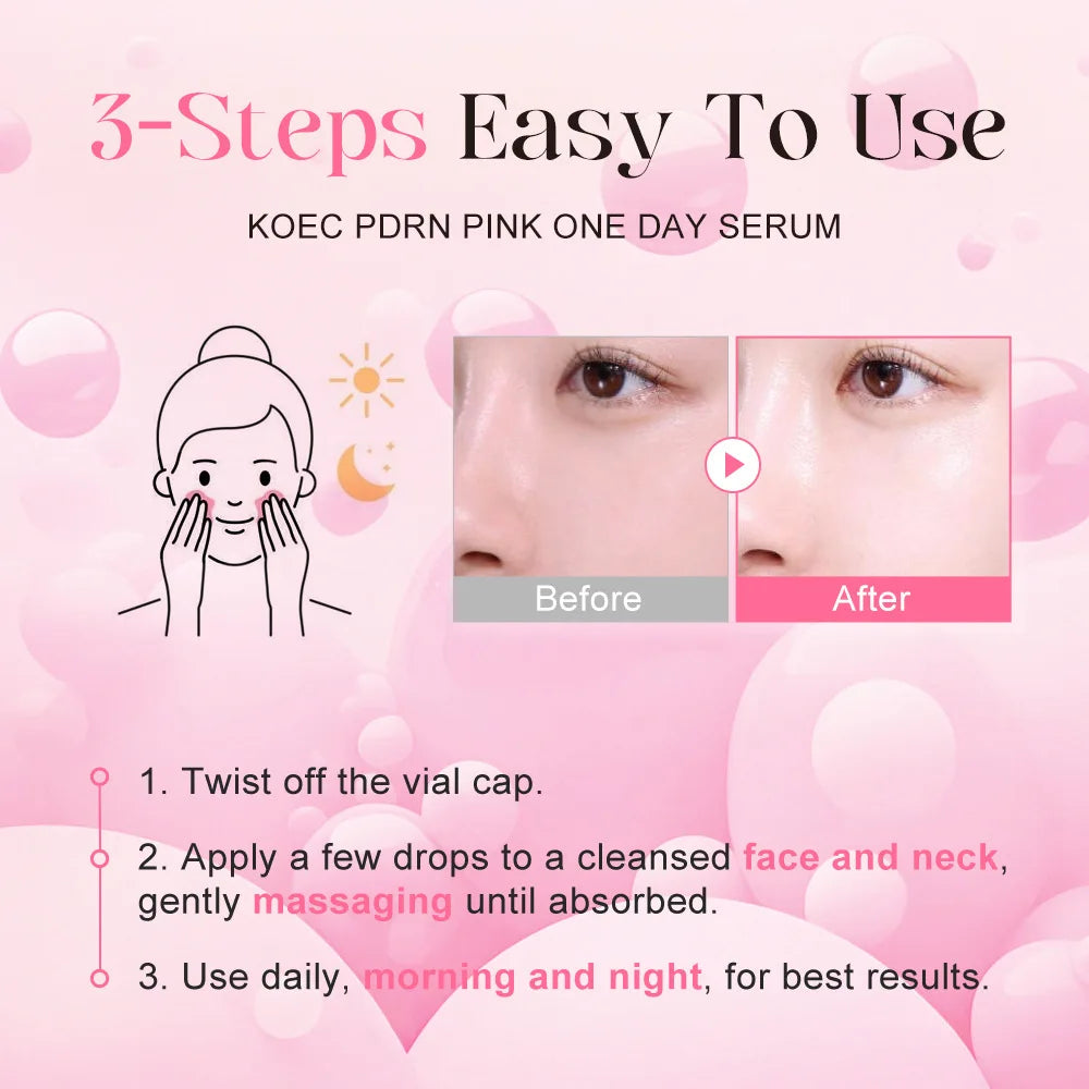 10Vials/Box PDRN PINK ONE DAY SERUM Firming Hydrating Ampoule Smoothing Skin Oil Control Pore Refining Skin Rejuvenation Essence
