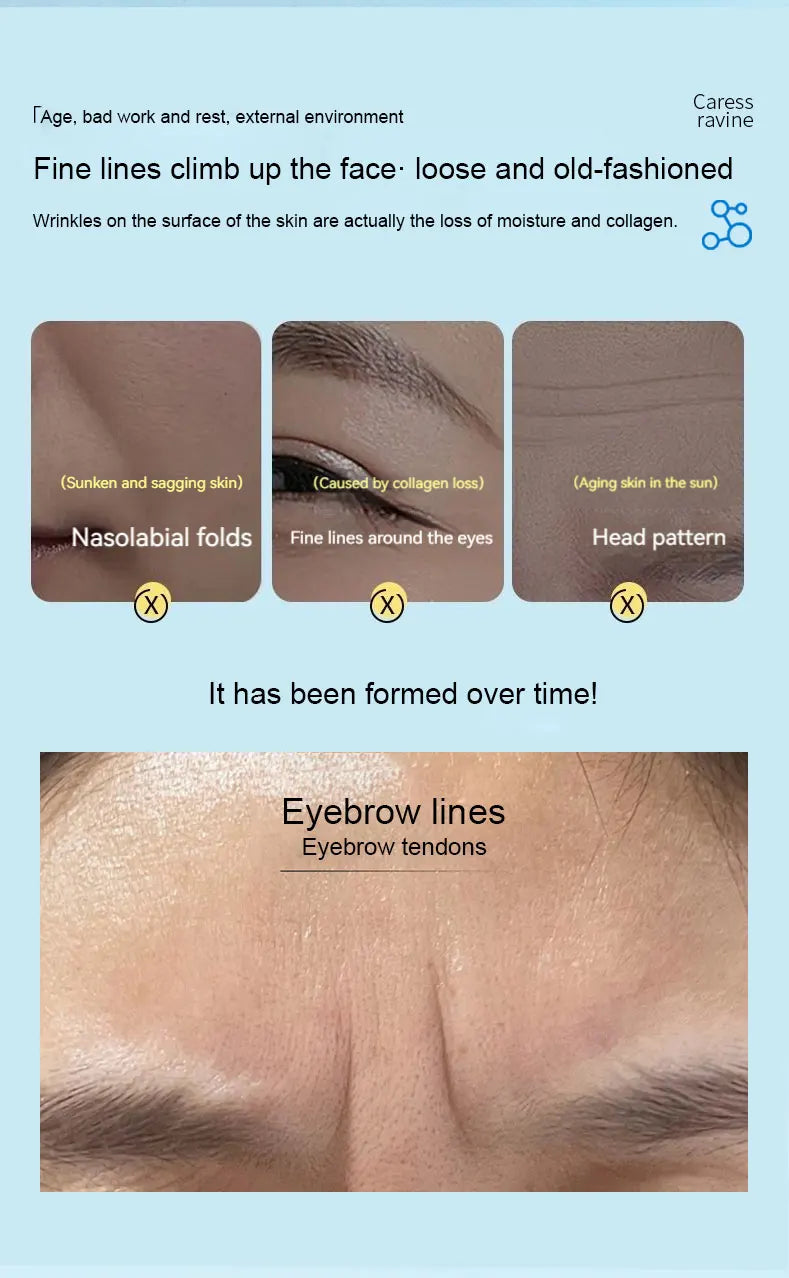 5/10PCS Recombinant Collagen Anti-Wrinkle Patch for Face Lift&Smooth Nasolabial Folds Smile Lines Firm&Tighten Skin Beauty Care