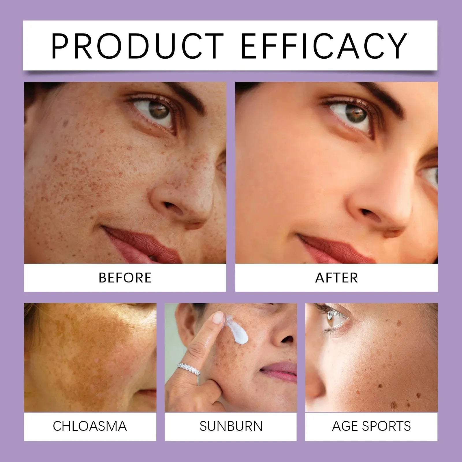 Retinol Whitening Freckle Cream Melasma Dark Spots Pigmentation Removal Fade Stain Melanin Fast Repair Brighten Korean Skin Care
