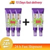 Retinol Whitening Freckle Cream Melasma Dark Spots Pigmentation Removal Fade Stain Melanin Fast Repair Brighten Korean Skin Care