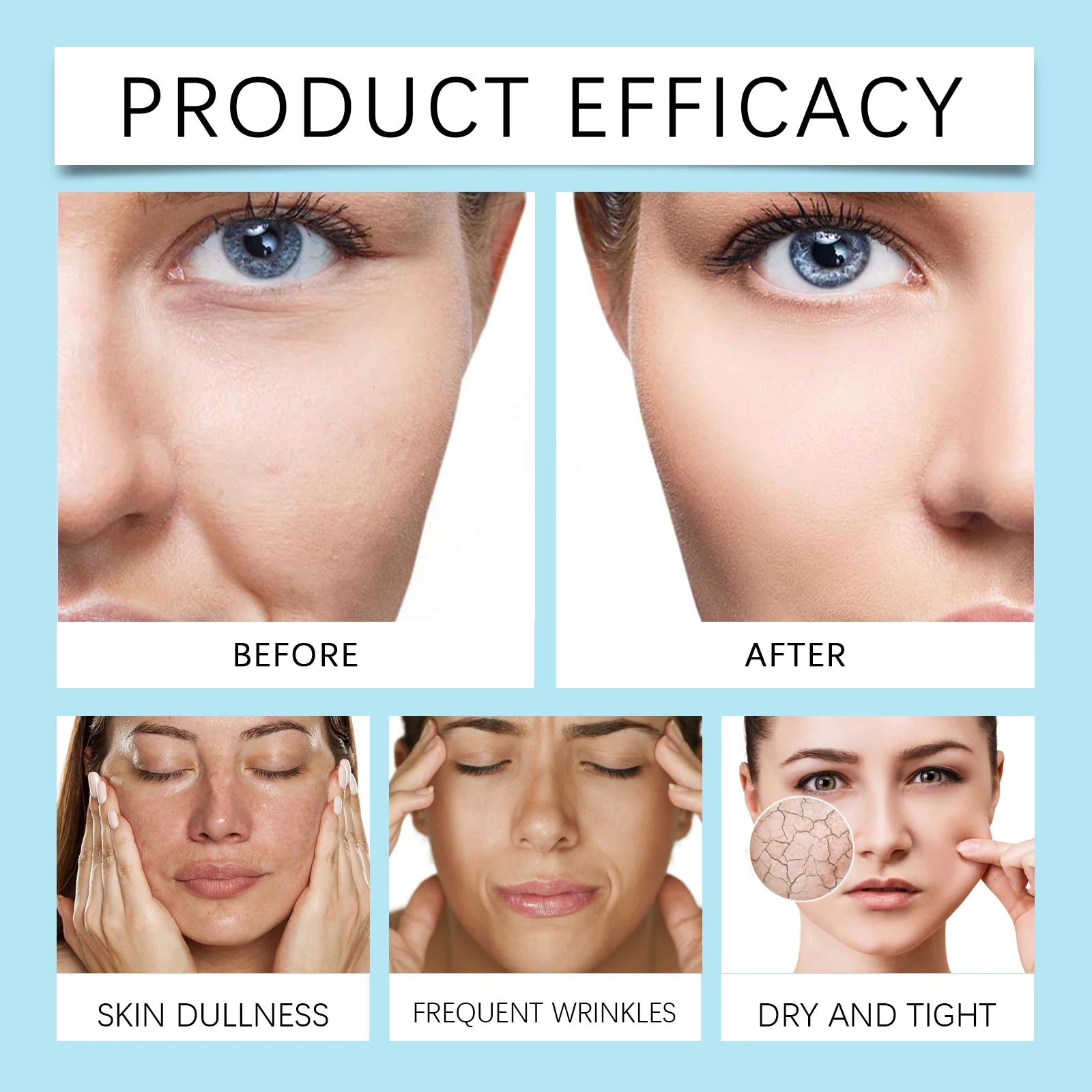 Centella Ultimate Moisturizing Cream Youthful Formula Collagen Niacinamide Centella Asiatica Hyaluronic Acid Wrinkles Spots Crea
