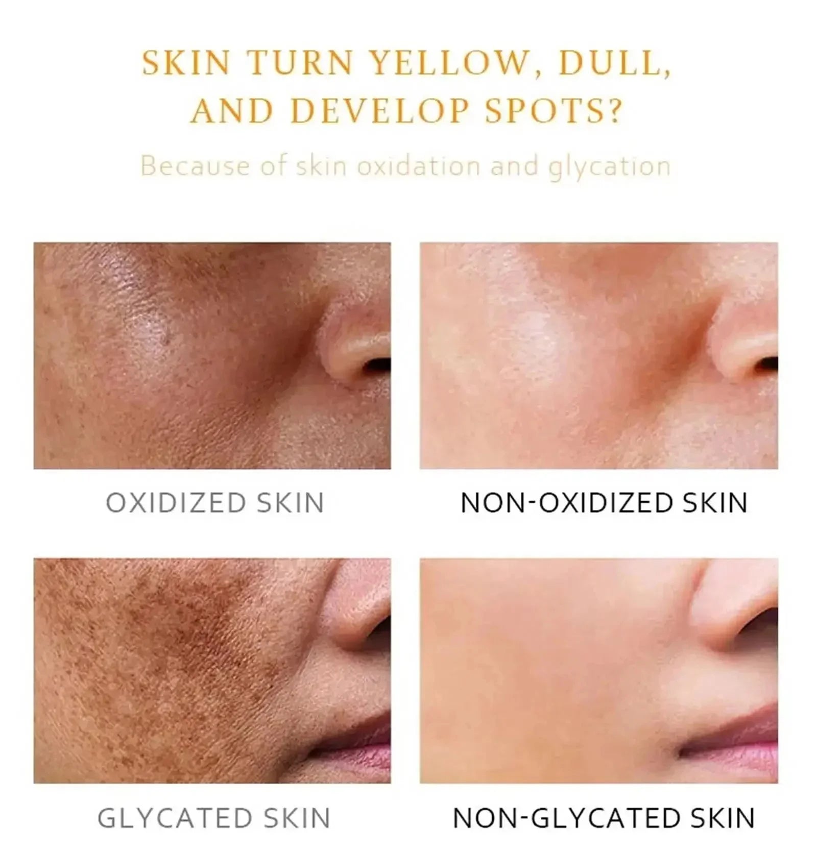 Retinol Whitening Freckle Cream Melasma Dark Spots Pigmentation Removal Fade Stain Melanin Fast Repair Brighten Korean Skin Care