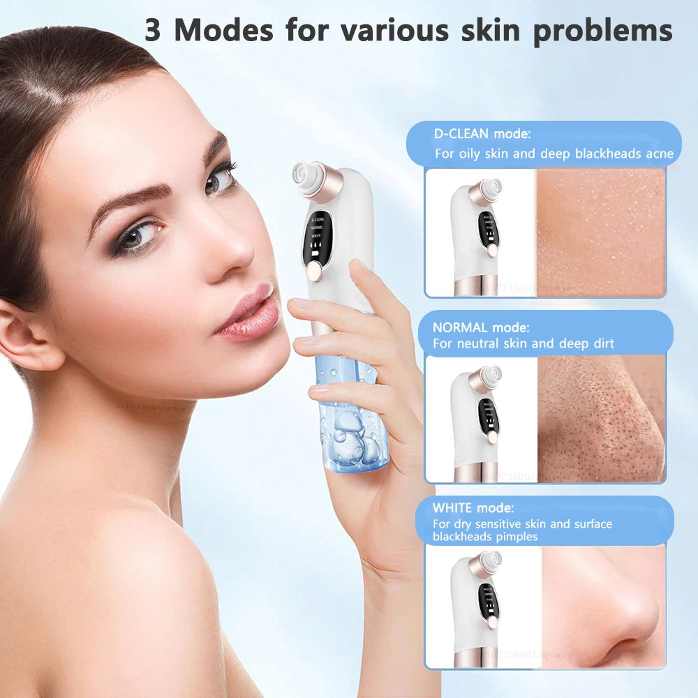 Blackhead Remover Pore Vacuum Facial Pore Cleaner Electric Comedone Whitehead Extractor Tool Rechargeable Blackhead Remover